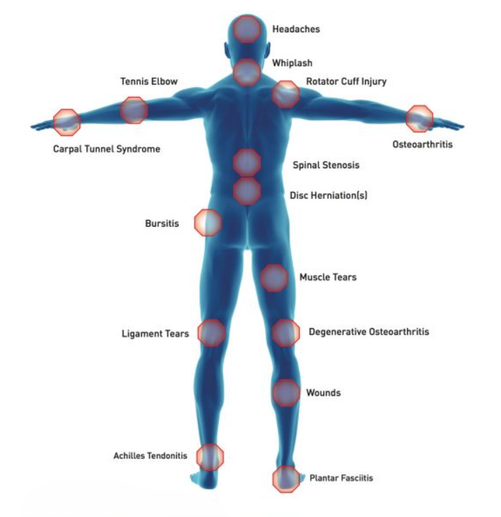 Pain Diagram